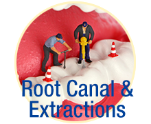 Root Canals & Extractions